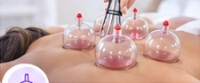 Visuel illustratif : Cupping Therapy